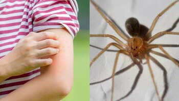 Alerta por mordedura de araña